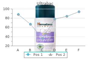 order cheapest ultrabac
