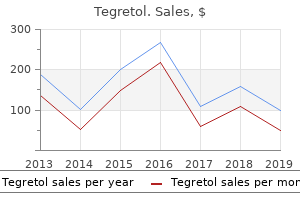 buy tegretol 400mg without a prescription