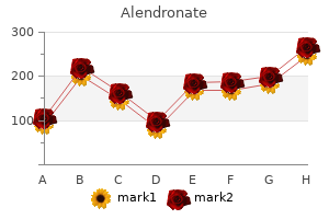buy alendronate 35 mg mastercard
