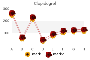 buy clopidogrel 75 mg overnight delivery