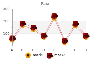 purchase paxil with a visa